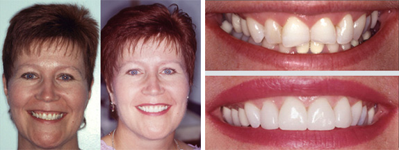 Cosmetic Dentist Swansea MA